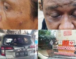 Mafia BBM Subsidi dan Tambang Emas Ilegal di Sijunjung, Wartawan Jadi Korban Persekusi Brutal