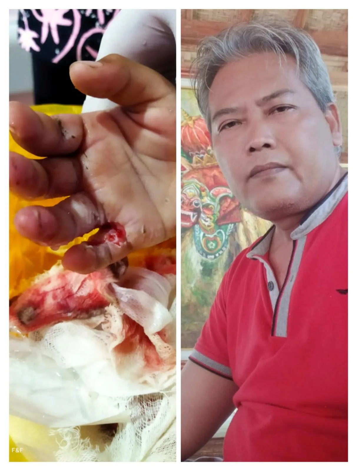 Halili Abdul Ghani : Taman Blambangan Mencekam, dan Memakan Korban
