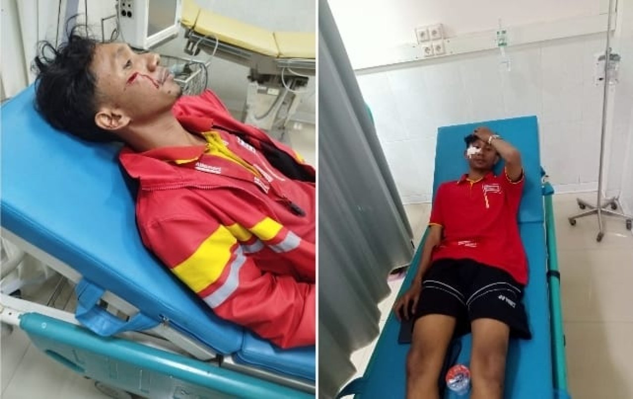 Minim Perhatian Dari Pemerintah, Jalan Rusak Bypass Cepu Memakan Korban