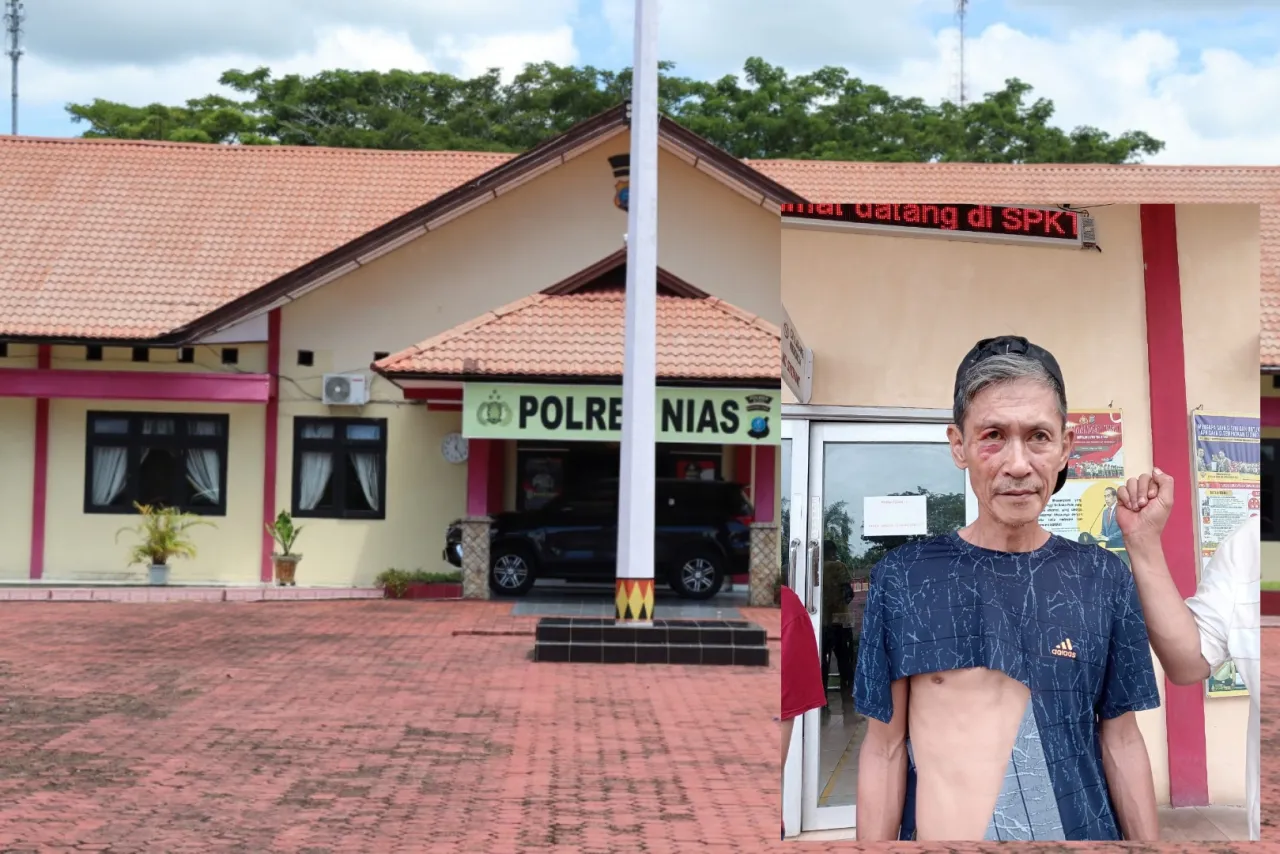 Diduga Oknum Polisi Terlibat Penganiayaan Fisik,salah seorang Warga di Desa Tarakhaini.