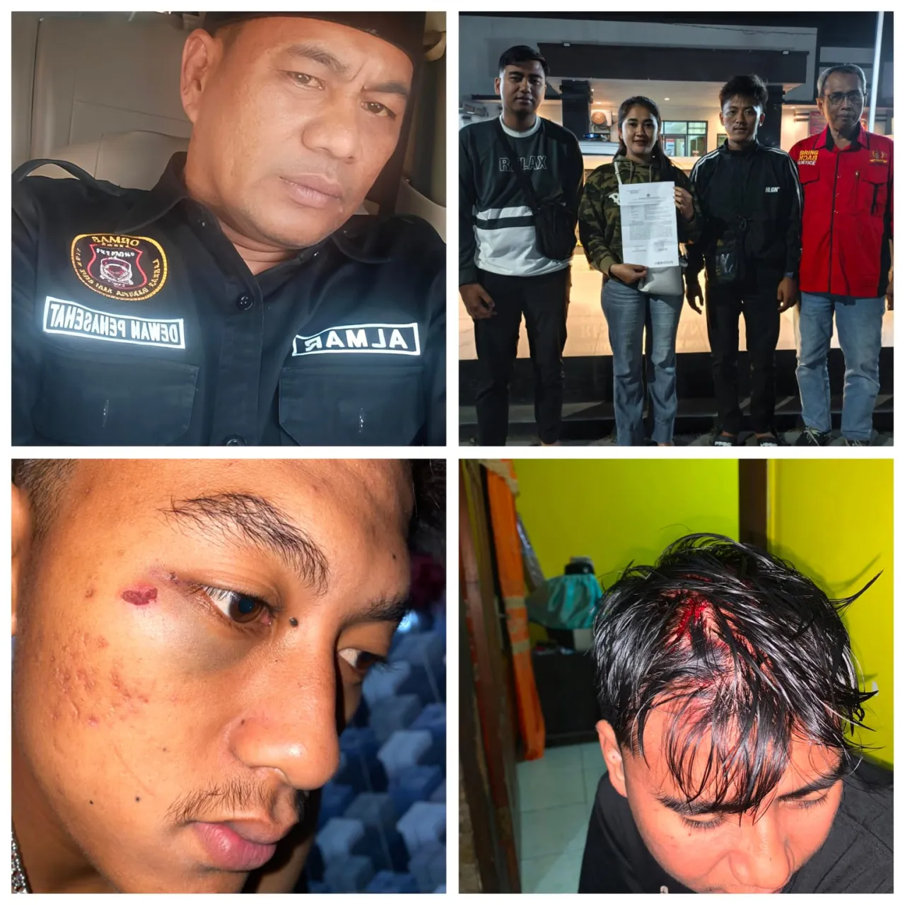 Buntut Pengeroyokan di Karnaval Sound Horeg, Polsek Jabung Panggil Kades Sidorejo